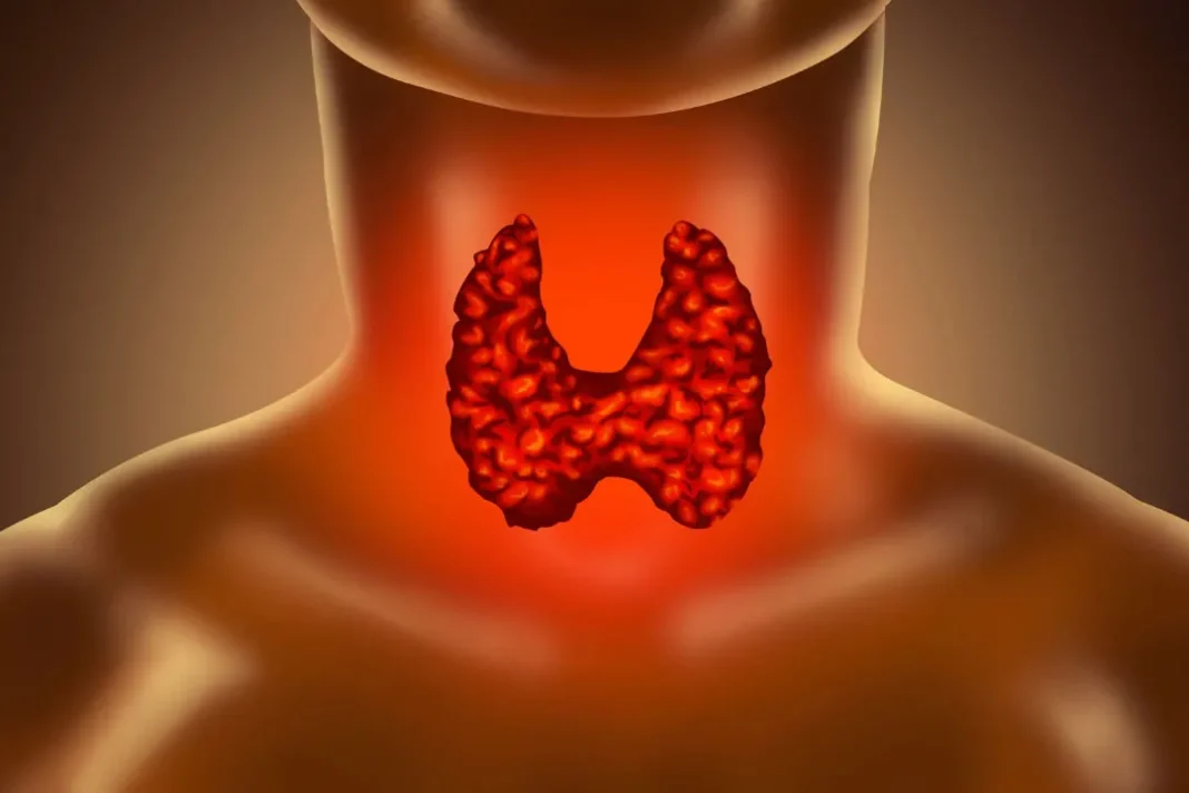 Autoimmune Hypophysitis.