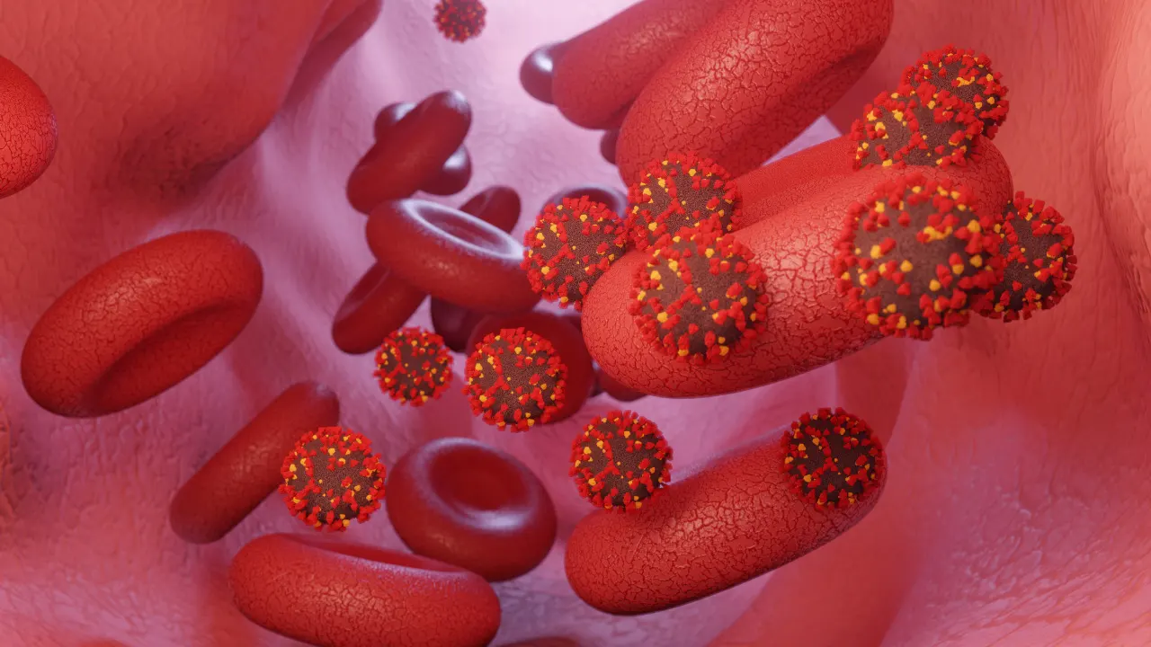 Autoimmune Hemolytic Anemia.